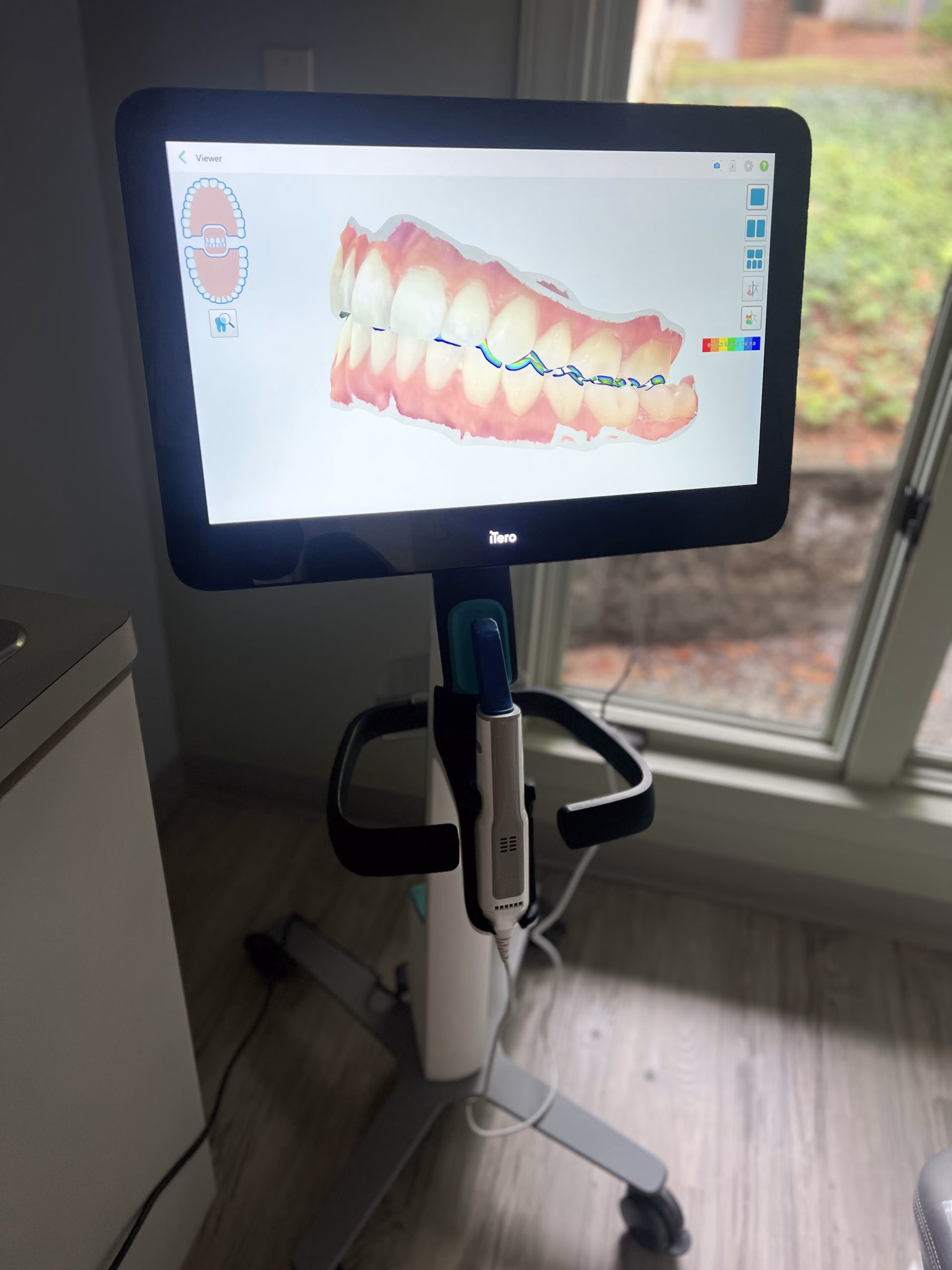 Dental Bridges Hickory NC